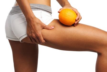 Cellulite causes and cure