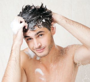 Scalp dandruff issue