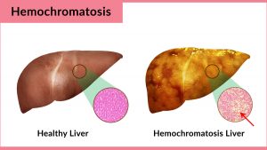 harmful effects of lemon juice